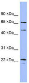 Mitogen-Activated Protein Kinase 4 antibody, TA342151, Origene, Western Blot image 
