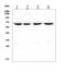 Caseinolytic Mitochondrial Matrix Peptidase Chaperone Subunit antibody, M00978, Boster Biological Technology, Western Blot image 