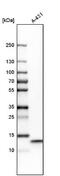Ubiquinol-Cytochrome C Reductase Binding Protein antibody, NBP1-80860, Novus Biologicals, Western Blot image 