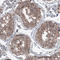B-Raf Proto-Oncogene, Serine/Threonine Kinase antibody, AMAb91258, Atlas Antibodies, Immunohistochemistry paraffin image 