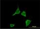 Calcium/Calmodulin Dependent Protein Kinase II Delta antibody, H00000817-M02, Novus Biologicals, Immunofluorescence image 