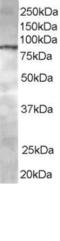 ArfGAP With Coiled-Coil, Ankyrin Repeat And PH Domains 1 antibody, LS-B2280, Lifespan Biosciences, Western Blot image 