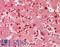 GP6 antibody, LS-B14017, Lifespan Biosciences, Immunohistochemistry paraffin image 