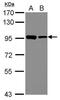 DExD-Box Helicase 21 antibody, PA5-30304, Invitrogen Antibodies, Western Blot image 