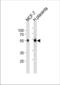ER-beta antibody, TA324671, Origene, Western Blot image 