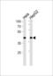LDL Receptor Related Protein Associated Protein 1 antibody, LS-C165869, Lifespan Biosciences, Western Blot image 