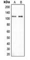 CAP-Gly Domain Containing Linker Protein 2 antibody, MBS822262, MyBioSource, Western Blot image 