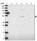 Sodium/bile acid cotransporter 5 antibody, HPA025966, Atlas Antibodies, Western Blot image 
