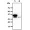 DHEA-ST antibody, GTX57723, GeneTex, Western Blot image 