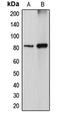 Diacylglycerol kinase alpha antibody, GTX55856, GeneTex, Western Blot image 