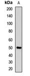 Sonic hedgehog protein antibody, LS-C668214, Lifespan Biosciences, Western Blot image 