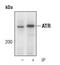 ATR Serine/Threonine Kinase antibody, PA5-17265, Invitrogen Antibodies, Immunoprecipitation image 