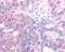 EGFR antibody, 48-395, ProSci, Immunohistochemistry paraffin image 