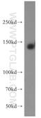 Receptor tyrosine-protein kinase erbB-4 antibody, 19943-1-AP, Proteintech Group, Western Blot image 