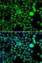 Structural Maintenance Of Chromosomes Flexible Hinge Domain Containing 1 antibody, PA5-77172, Invitrogen Antibodies, Immunofluorescence image 