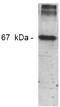 Nitrotyrosine antibody, AM00099PU-N, Origene, Western Blot image 