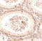Spermatogenesis Associated 3 antibody, 6551, ProSci, Immunohistochemistry paraffin image 