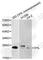Von Hippel-Lindau Tumor Suppressor antibody, A0377, ABclonal Technology, Western Blot image 