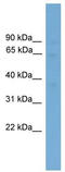 Ferroportin-1 antibody, TA333866, Origene, Western Blot image 
