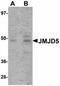 Lysine Demethylase 8 antibody, orb94325, Biorbyt, Western Blot image 