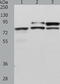 Disintegrin and metalloproteinase domain-containing protein 15 antibody, TA324248, Origene, Western Blot image 