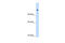 SWI/SNF Related, Matrix Associated, Actin Dependent Regulator Of Chromatin, Subfamily A Like 1 antibody, 28-999, ProSci, Western Blot image 