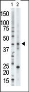 VRK Serine/Threonine Kinase 1 antibody, AP14050PU-N, Origene, Western Blot image 