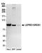 Prolyl 3-Hydroxylase 1 antibody, A304-998A, Bethyl Labs, Western Blot image 