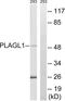 PLAG1 Like Zinc Finger 1 antibody, LS-B9265, Lifespan Biosciences, Western Blot image 