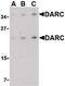 Atypical Chemokine Receptor 1 (Duffy Blood Group) antibody, PA5-20357, Invitrogen Antibodies, Western Blot image 