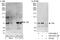 Nuclear receptor subfamily 2 group C member 1 antibody, A303-046A, Bethyl Labs, Western Blot image 