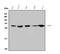 Replication Protein A2 antibody, A02067-1, Boster Biological Technology, Western Blot image 