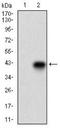 CD74 Molecule antibody, NBP2-37341, Novus Biologicals, Western Blot image 