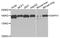 Protein diaphanous homolog 1 antibody, TA332904, Origene, Western Blot image 