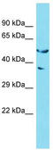 Golgin A6 Family Like 2 antibody, TA337324, Origene, Western Blot image 