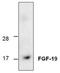 Fibroblast Growth Factor 19 antibody, TA319095, Origene, Western Blot image 