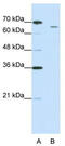 Cleavage and polyadenylation specificity factor subunit 3 antibody, TA343845, Origene, Western Blot image 