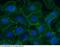 Coagulation Factor III, Tissue Factor antibody, 13133-MM05, Sino Biological, Immunohistochemistry frozen image 