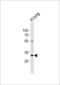 Colony Stimulating Factor 2 Receptor Alpha Subunit antibody, LS-C157664, Lifespan Biosciences, Western Blot image 