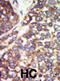 Gamma-PAK antibody, abx033767, Abbexa, Western Blot image 