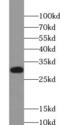 X-Box Binding Protein 1 antibody, FNab09537, FineTest, Western Blot image 