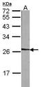NME/NM23 Family Member 5 antibody, GTX102475, GeneTex, Western Blot image 