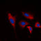 Inositol Polyphosphate-5-Phosphatase J antibody, LS-C356128, Lifespan Biosciences, Immunofluorescence image 