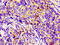 Leucine-rich repeat-containing G-protein coupled receptor 6 antibody, CSB-PA884515LA01HU, Cusabio, Immunohistochemistry paraffin image 