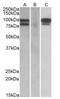 Proprotein Convertase Subtilisin/Kexin Type 9 antibody, AP22407PU-N, Origene, Western Blot image 