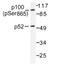 Nuclear factor NF-kappa-B p100 subunit antibody, AP01641PU-N, Origene, Western Blot image 