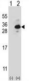 Clathrin Light Chain B antibody, AP50978PU-N, Origene, Western Blot image 