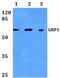 Guanylate Binding Protein 1 antibody, PA5-75381, Invitrogen Antibodies, Western Blot image 