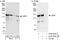 Ubiquitin carboxyl-terminal hydrolase 8 antibody, A302-929A, Bethyl Labs, Immunoprecipitation image 
