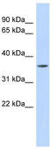Matrix Metallopeptidase 23B antibody, TA341872, Origene, Western Blot image 